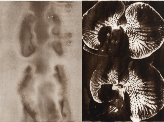 From Lucy Kim's exhibit, Chapter One: Melanin Images via Genetically-Modified Bacteria